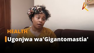 Tatizo La Kuishi Na Mai Makubwa - Gigantomastia Siha Yangu