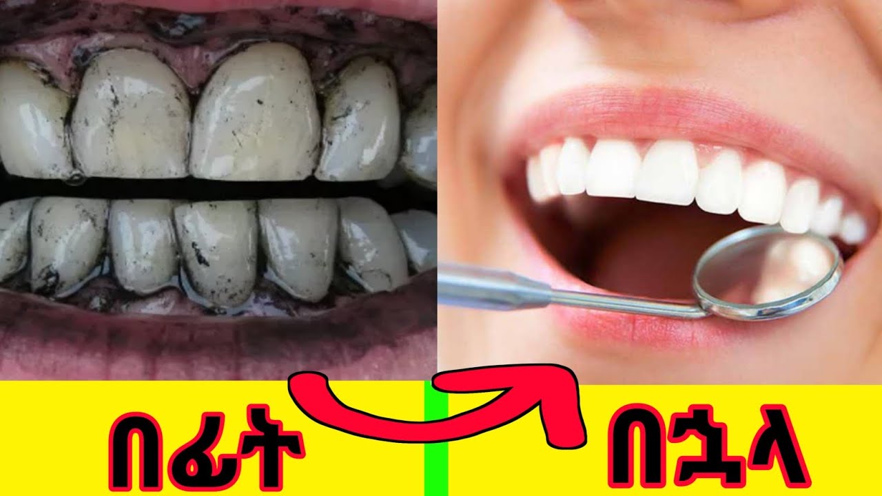 how-to-clean-teeth-at-home-youtube