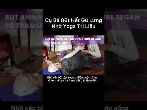 Vẹo Cột Sống,