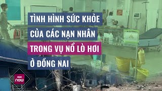 Tình hình sức khỏe các nạn nhân vụ nổ lò hơi ỏ Đồng Nai | VTC Now