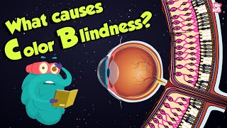 What Causes Color Blindness? | WhatIs COLOR BLINDNESS? | Dr Binocs Show | Peekaboo Kidz
