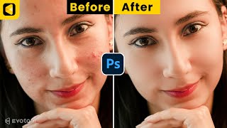 Remove Blemishes in Photoshop 2025 | Photoshop Tutorial | Retouch Skin using Photoshop screenshot 2