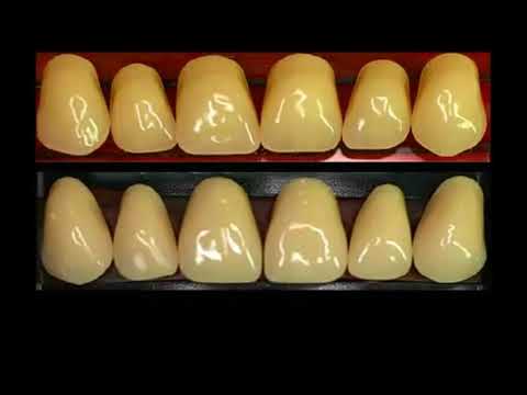 Video: Zubna Protetika - Koja Je Vrsta Proteze Bolja?