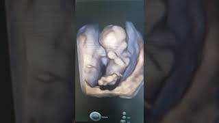 VID 20240211 WA0002