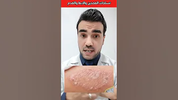 علاج تسلخات بين الفخذين وتحت الابطين و بين الأصابع دكتور محمود الخولي التهابات تسلخات جلدية 