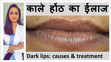 काले होंठ I कारण और ईलाज I How to get pink lips | Lighten dark lips | Home remedy | Dermatologist