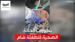 تطورات الحالة الصحية للطفلة شام.. مهددة ببتر ساقيها