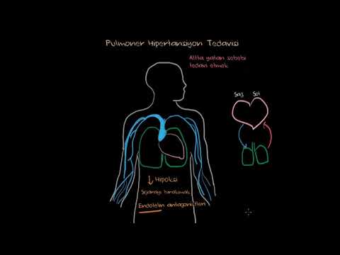 Pulmoner Hipertansiyon Tedavisi (Fen Bilimleri) (Sağlık ve Tıp)