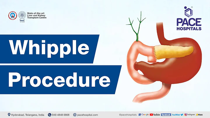 The Whipple Procedure | Indications, Steps, Success Rate and Complications