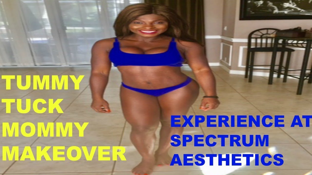 Tummy Tuck Mommy Makeover At Spectrum Aesthetics In Miami Dr Mel Ortega My Experience With Dr Mel Youtube