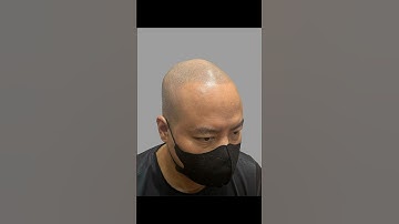 Anh chị chấm mấy điểm cho anh thợ xăm tóc này #xămtóc #hói_đầu #reviewxămtóc