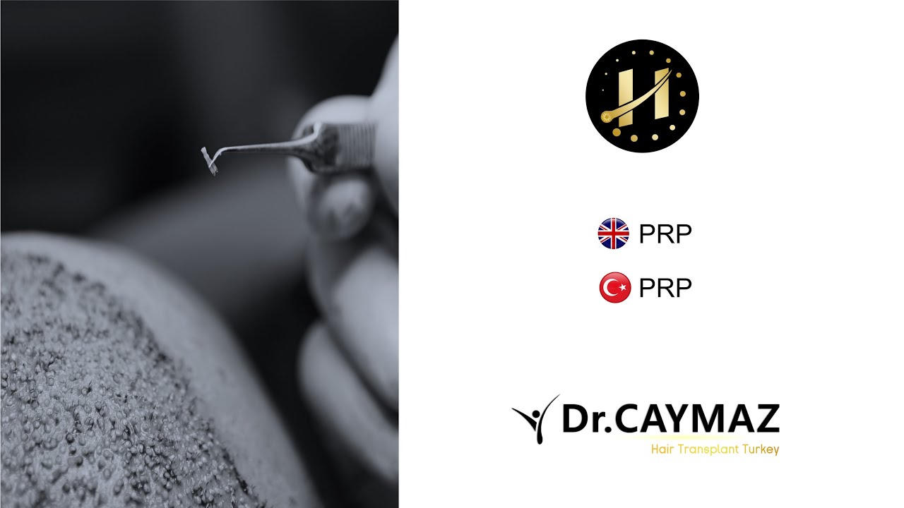 PRP - Platelet Rich Plasma Treatment | Dr Erkam Caymaz - Hair Transplant in Turkey