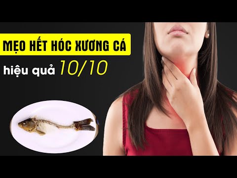 Mẹo dân gian chữa hóc xương cá nhanh nhất – đơn giản, hiệu quả 10/10