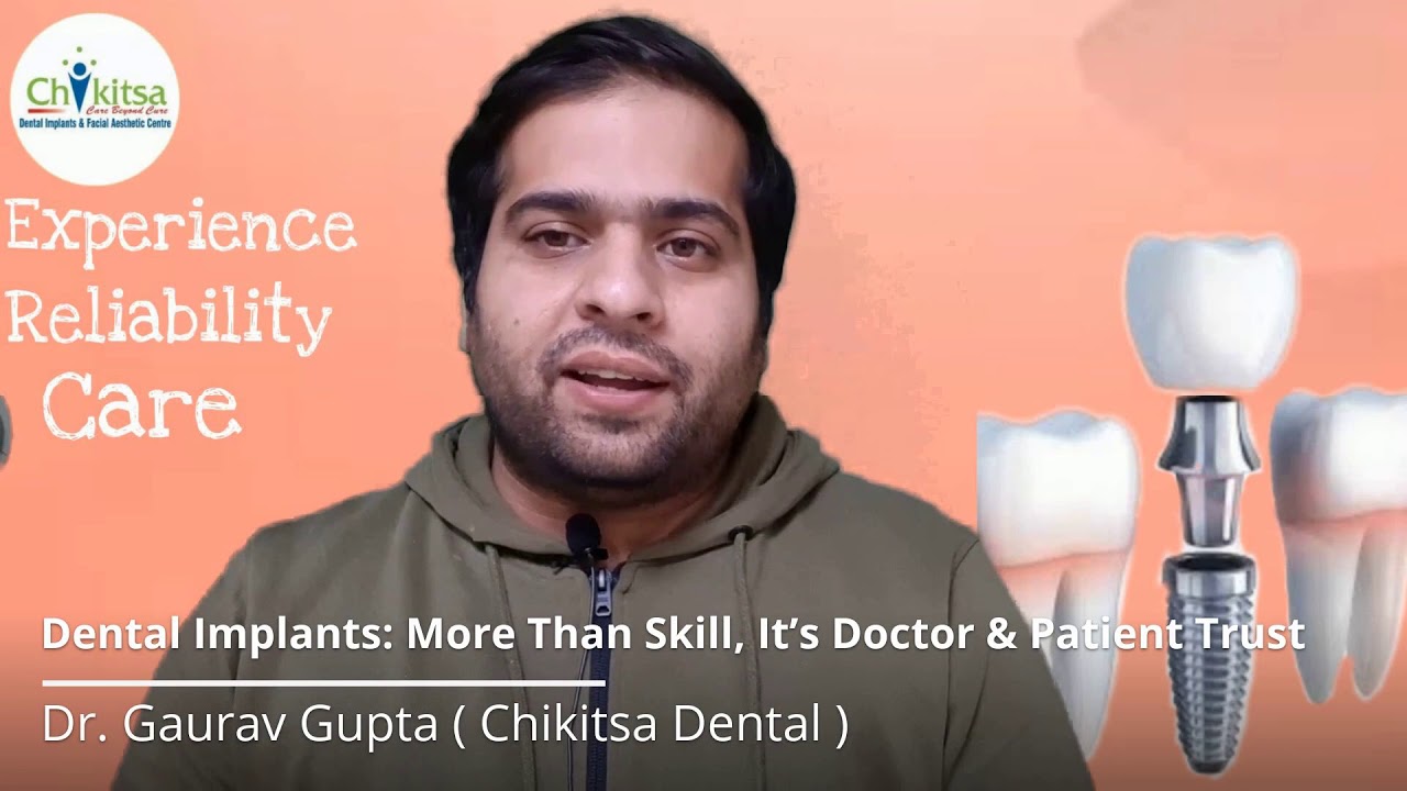 Dental Implants: More Than Skills, It's Doctor Patient Trust