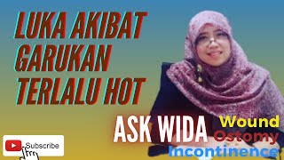 ASK WIDA 35 | Perawatan luka akibat garukan terlalu HOT!