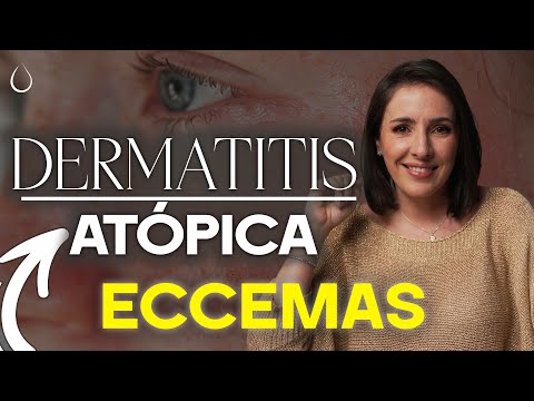 Viviendo con Dermatitis Atópica: Consejos y Tratamientos Eficaces @drapilarochoa - Dermatologa