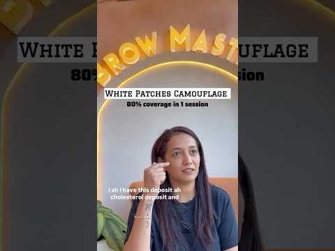 Cholesterol Deposit Marks Camouflage By Ashmeey | Brow Master Mumbai #shorts #skintreatment #beauty