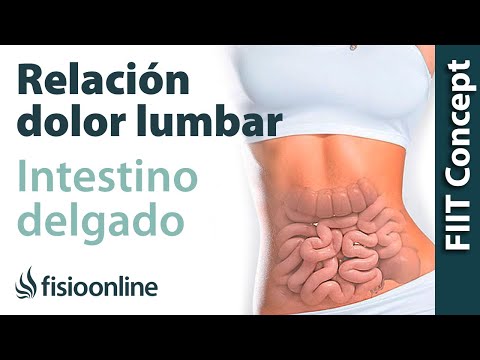 Video: ¿El dolor de la diverticulitis puede irradiarse a la espalda?