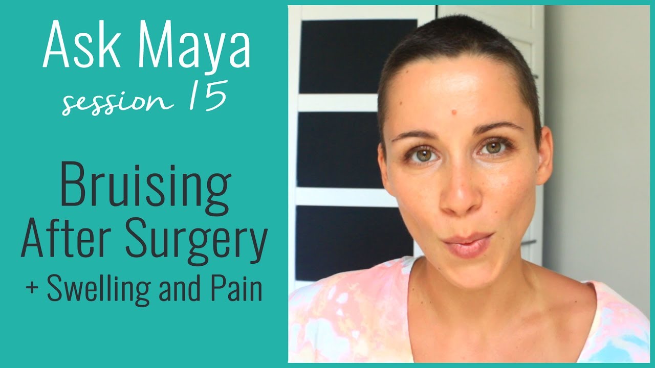ask-maya-15-why-do-you-bruise-more-easily-after-surgery-and-how-to