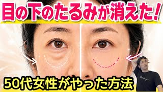 目の下のたるみが急増中⚠️現代の目のたるみは『眼精疲労』が原因！今ならまだ間に合う【たるみ解消】