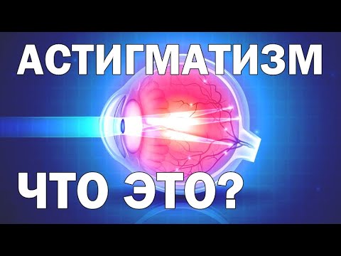 Что Такое  Миопический Астигматизм и Как Его Исправить?