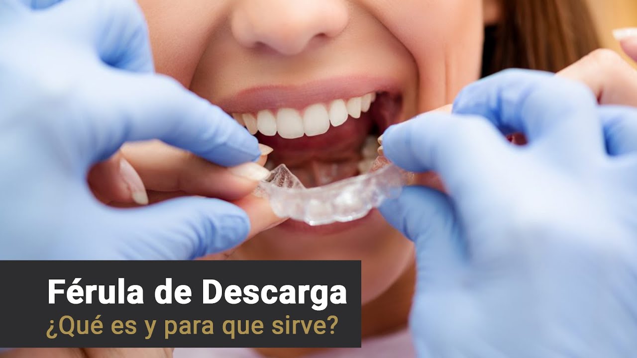 FÉRULA DE DESCARGA - Clinica Dental Fabián López