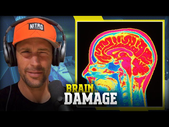 Does Vince Have Brain Damage | proyectosarquitectonicos.ua.es