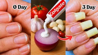 grow nails in just 3 days ||faster nail growth tips || How to grow Nails  faster in one day |