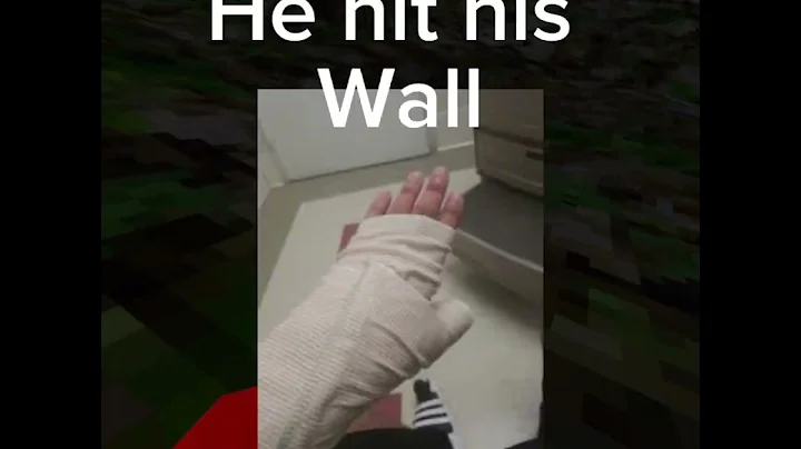 Worst, gorilla tag injuries  pt 1 #gorilla #1000subs #gorillatag #youtubesubscribers #gaming #funny￼