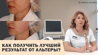 СМАС ЛИФТИНГ АЛЬТЕРА 💥 КАК ПОЛУЧИТЬ ЛУЧШИЙ РЕЗУЛЬТАТ ОТ БЕЗОПЕРАЦИОННОЙ ПОДТЯЖКИ ЛИЦА⁉️