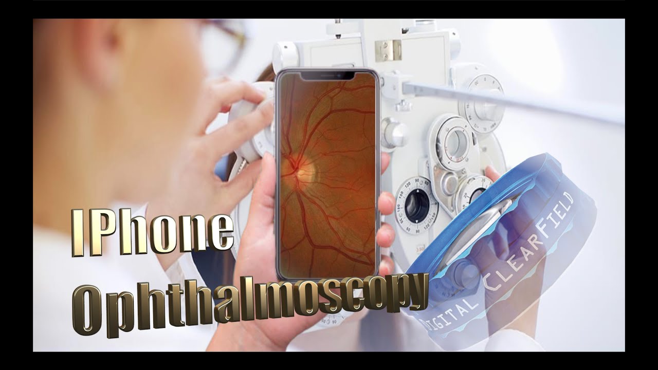 Smartphone Ophthalmoscopy YouTube