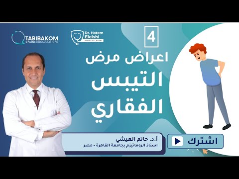 أعراض مرض التيبس الفقارى أ د حاتم العيشى