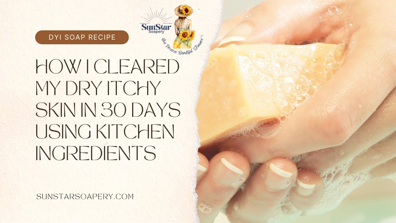 How I Cleared My Dry Itchy Skin in 30 Days Using Kitchen Ingredients ...