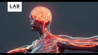Phase 1 Study of AAV9.LAMP2B Gene Therapy in Patients with Danon Disease Update