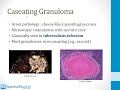 Pathology 1 General Topics 8 Granulomatous Inflammation atf