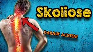 Skoliose Therapie: Warum wird dieser Weg so oft übersehen? Muskeltraining statt OP