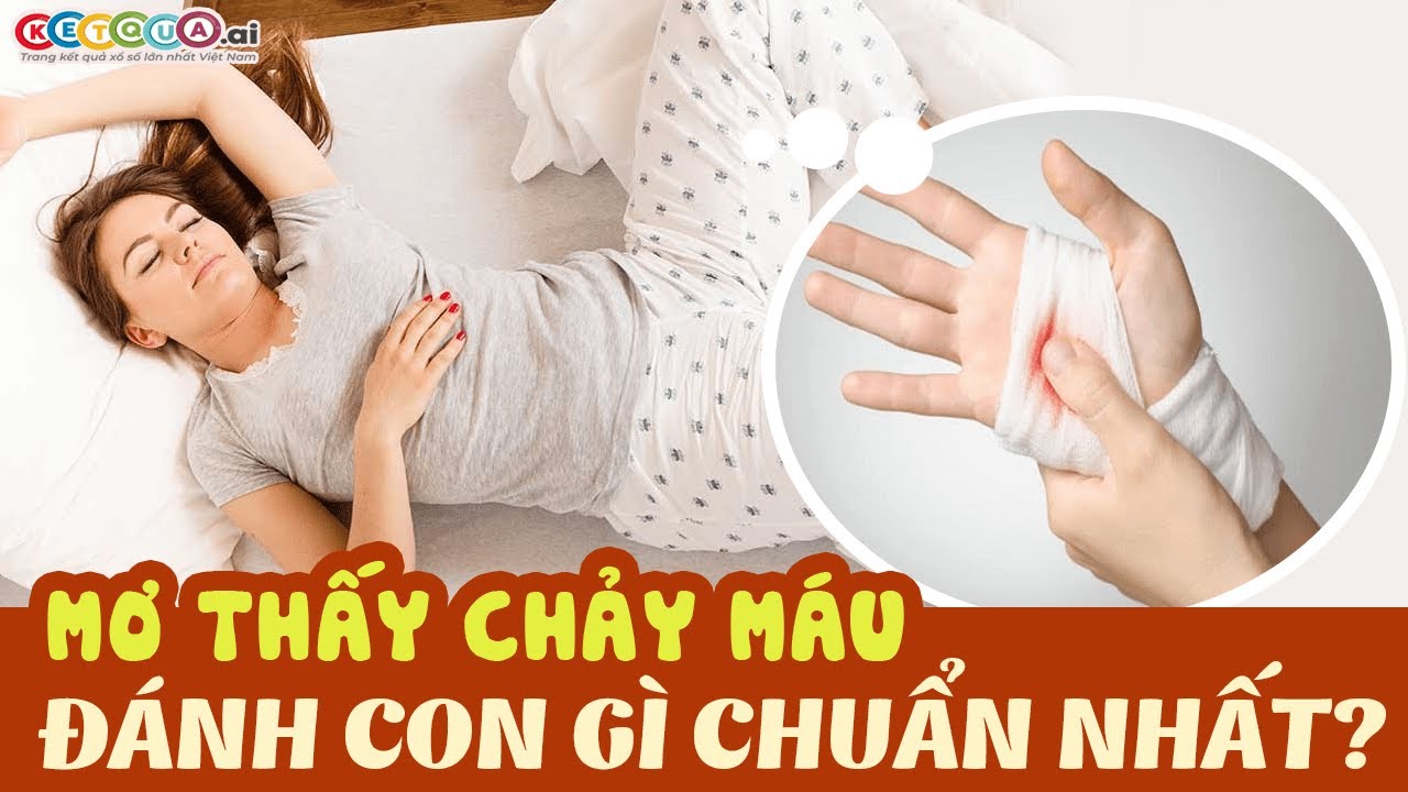 tro choi pirate kings Nằm mơ thấy chảy máu đánh con gì? Giải mã giấc mơ thấy chảy máu