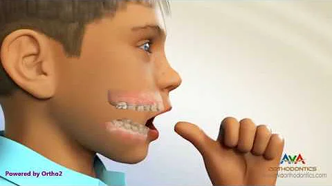 Come sbloccare un bambino che non parla?