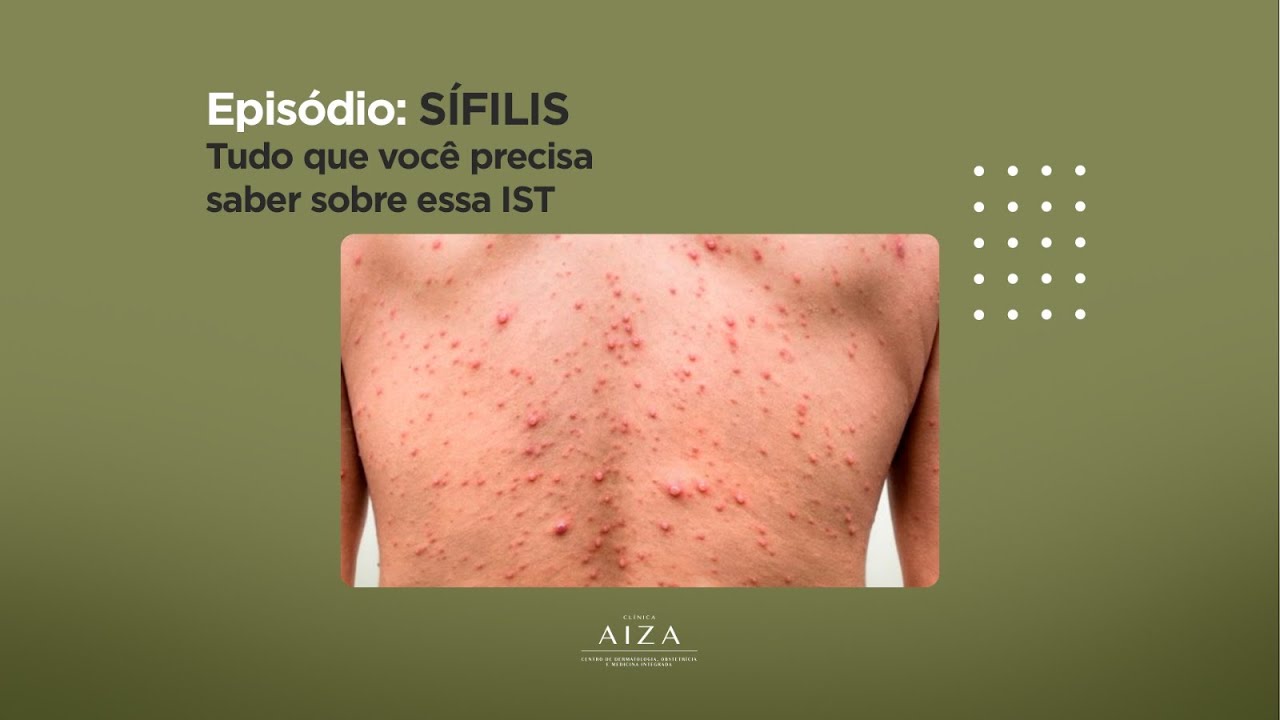 Sífilis tem cura? Saiba causas, sintomas, prevenção e como tratar a ...