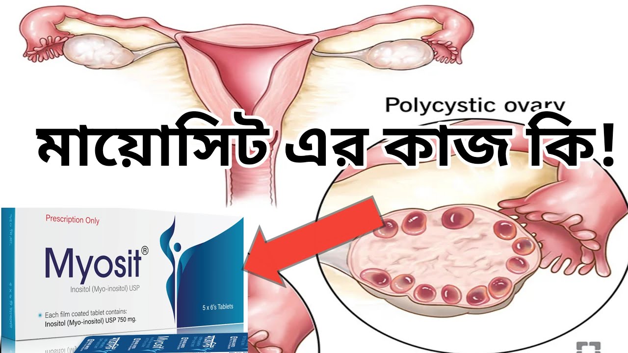 Myosit মায়োসিট ৭৫০ এর কাজ কি Myosit Tablet.নারীদের গোপন রোগের ঔষধ। Inositol ...