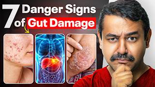 7 Visible & Early Danger Signs Of Gut Damage You Should Never Ignore