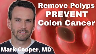 What Happens If You Have Colon Poylps?