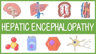 Understanding Hepatic Encephalopathy with Mnemonics