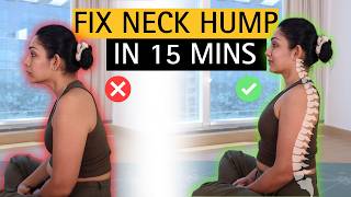 Say Goodbye to Neck Hump and Forward Head Posture