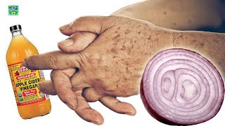 Do You Have Age Spots On Your Skin? Remove Them With This Simple Ingredient