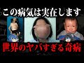 閲覧注意。実在する怖すぎる奇病７選【ゆっくり解説】