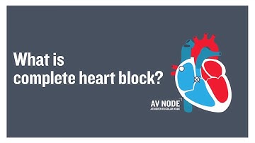 What is complete heart block?