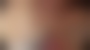 Laparoscopic liver left lateral sectionectomy - vaginal specimen extraction