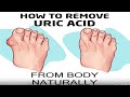 How to remove Uric acid from your body naturally