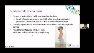 OrthoFracs Achondroplasia Summary by Dr Muqtasid Hussaini